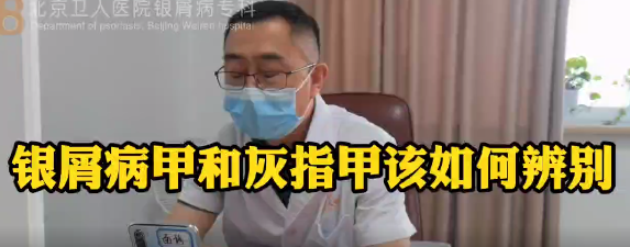 王强医生科普：怎样辨别银屑病甲与灰指甲