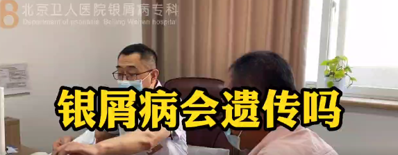 王强医生科普：银屑病会遗传吗